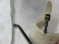 Implantologie Fortbildung