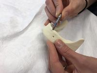 Implantologie Fortbildung