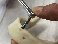 Implantologie Fortbildung