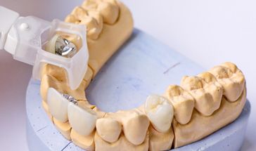 Amalgam-Sanierung beim ganzheitlichen Zahnarzt in Fürth
